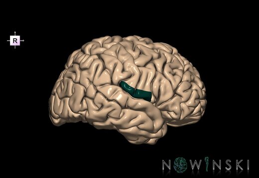 G1.T6.23.V4.C13.L0.Subcentral gyrus right