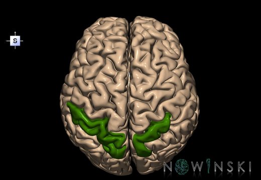 G1.T6.26.V5.C13.L0.Superior parietal lobule