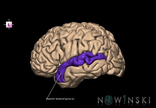 G1.T6.27.V2.C13.L1.Superior temporal gyrus left