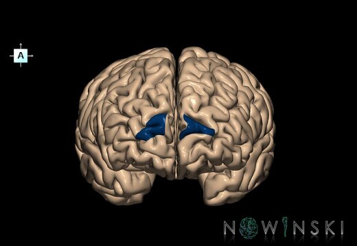 G1T6.29.TransverseFrontopolarGyri