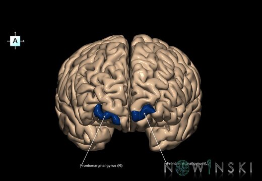 G1.T6.4.V1.C13.L1.Frontomarginal gyrus