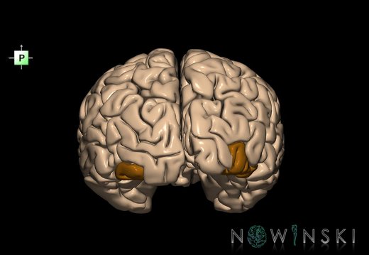 G1T6.7.InferiorOccipitalGyrus