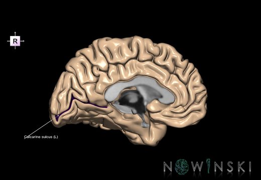 G1.T7.1.V4.C14.L1.Calcarine sulcus left