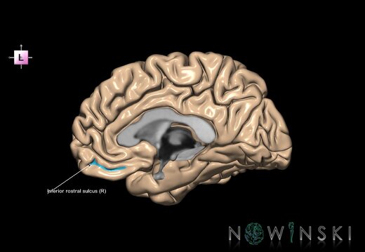 G1.T7.10.V2.C14.L1.Inferior rostral sulcus right