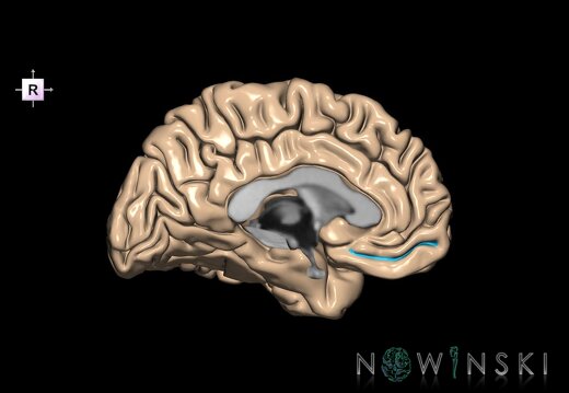 G1.T7.10.V4.C14.L0.Inferior rostral sulcus left