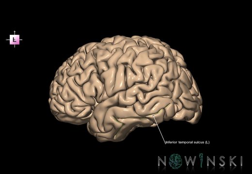 G1.T7.11.V2.C14.L1.Inferior temporal sulcus left