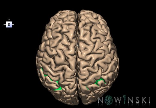 G1.T7.12.V5.C14.L0.Intraparietal sulcus