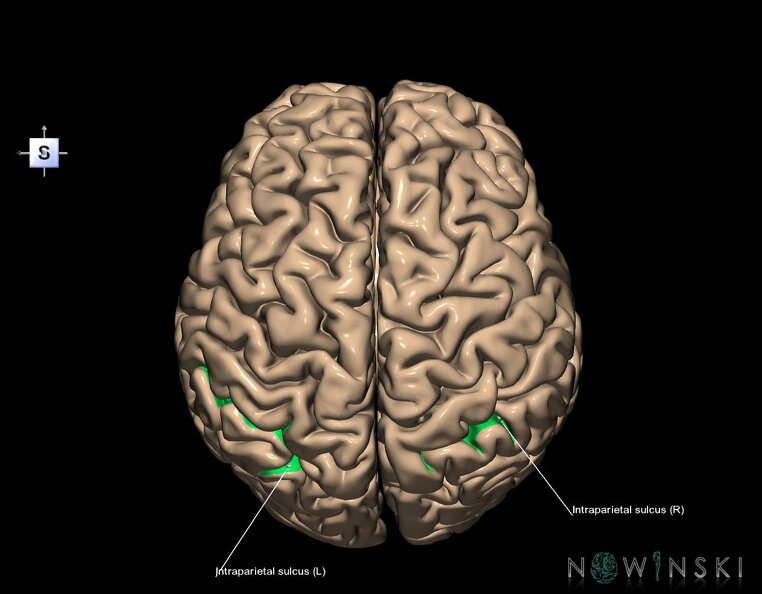 G1.T7.12.V5.C14.L1.Intraparietal_sulcus.tiff