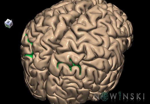 G1.T7.12.V8.C14.L0.Intraparietal sulcus