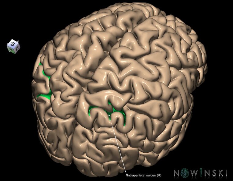 G1.T7.12.V8.C14.L1.Intraparietal_sulcus.tiff