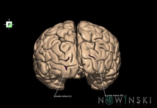 G1.T7.13.V3.C14.L1.Lunate sulcus