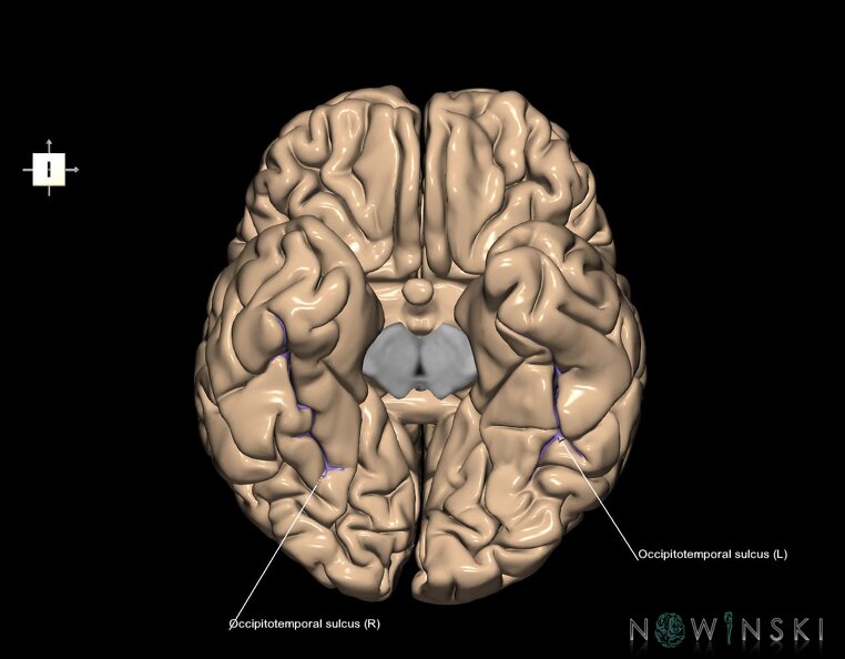 G1.T7.14.V6.C14.L1.Occipitotemporal_sulcus.tiff