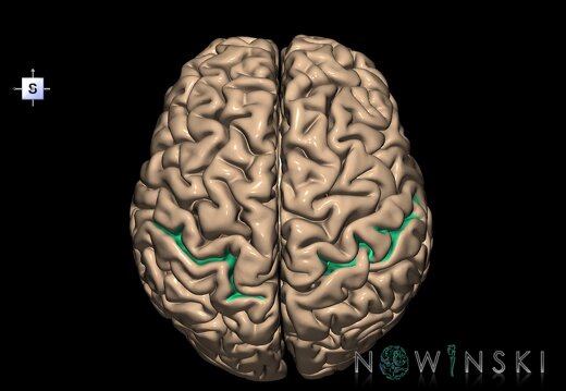 G1.T7.18.V5.C14.L0.Postcentral sulcus