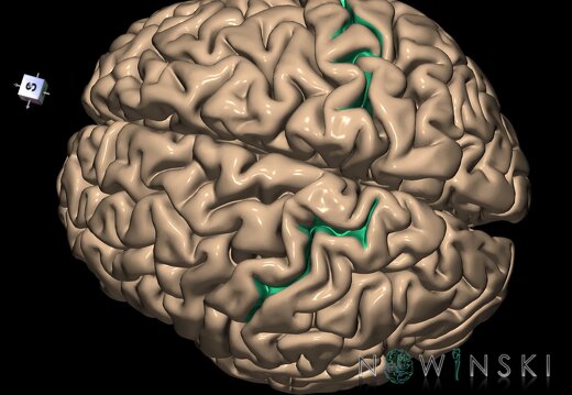 G1.T7.18.V7.C14.L0.Postcentral sulcus