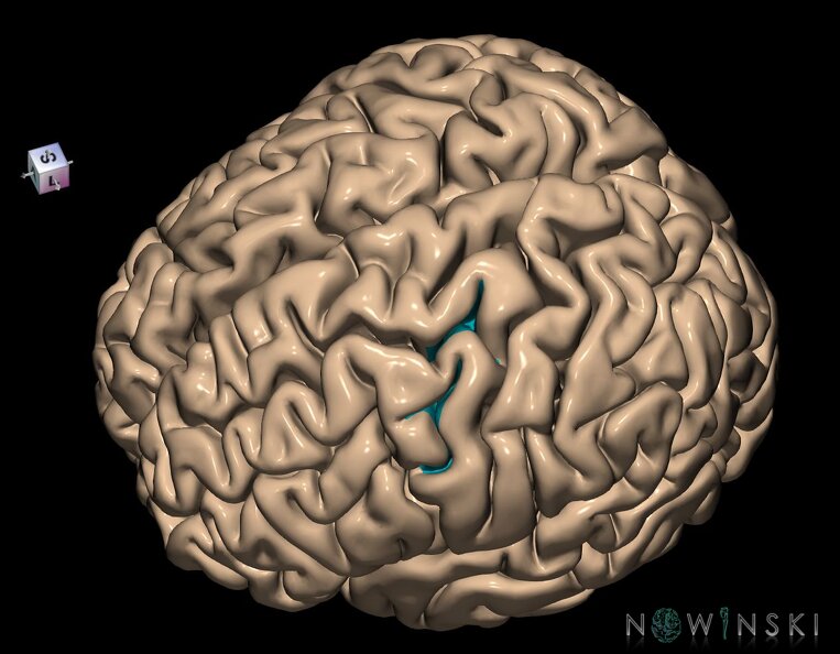 G1.T7.19.V7.C14.L0.Precentral_sulcus.tiff