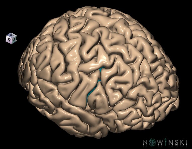 G1.T7.19.V8.C14.L0.Precentral_sulcus.tiff