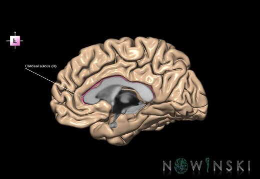G1.T7.2.V2.C12.L1.Callosal sulcus right