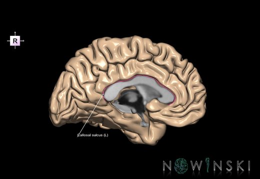 G1.T7.2.V4.C12.L1.Callosal sulcus left