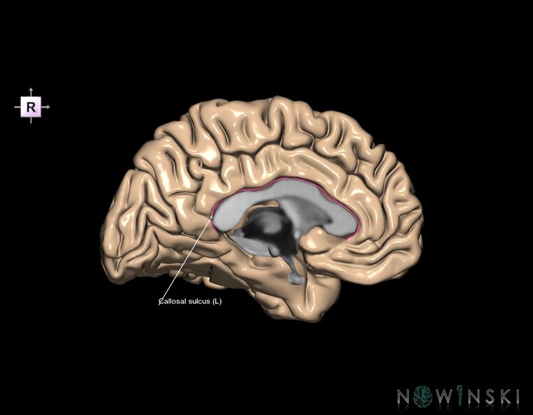 G1.T7.2.V4.C12.L1.Callosal_sulcus_left.tiff