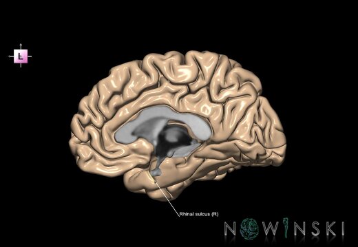 G1.T7.20.V2.C14.L1.Rhinal sulcus right