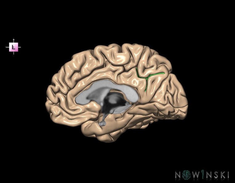 G1.T7.21.V2.C14.L0.Subparietal_sulcus_right.tiff