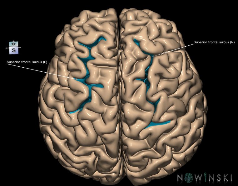 G1.T7.22.V7.C14.L1.Superior_frontal_sulcus.tiff