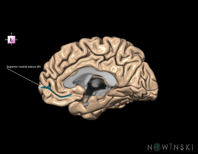 G1.T7.24.V2.C14.L1.Superior_rostral_sulcus_right.tiff