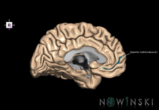 G1.T7.24.V4.C14.L1.Superior rostral sulcus left