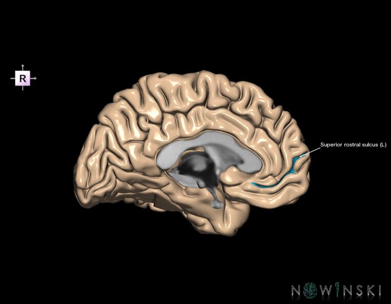 G1.T7.24.V4.C14.L1.Superior_rostral_sulcus_left.tiff