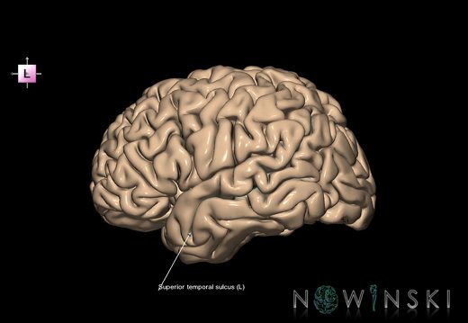 G1.T7.25.V2.C14.L1.Superior temporal sulcus left