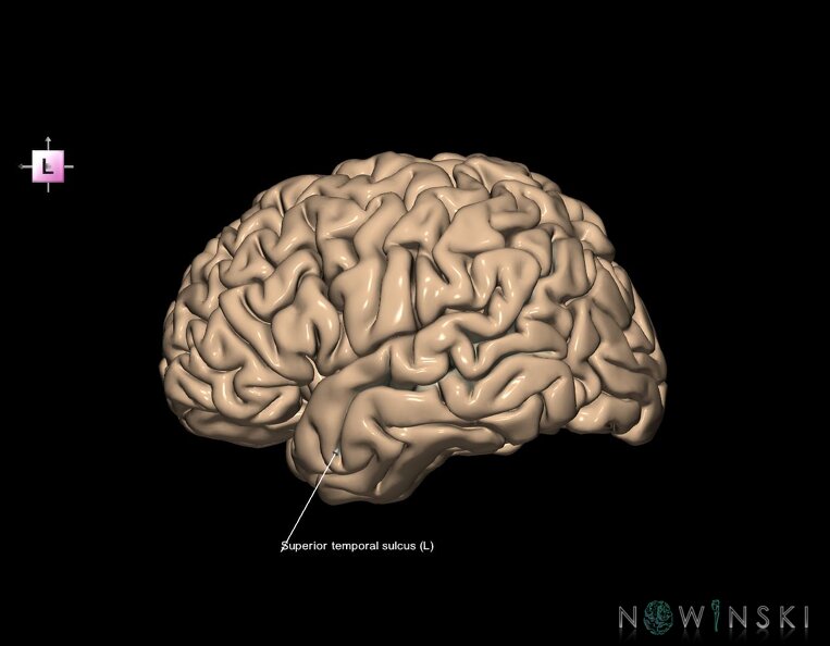 G1.T7.25.V2.C14.L1.Superior_temporal_sulcus_left.tiff