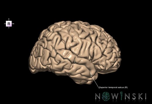 G1.T7.25.V4.C14.L1.Superior temporal sulcus right