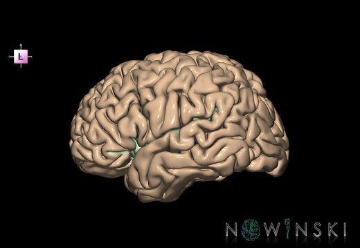 G1.T7.26.V2.C14.L0.Sylvian fissure left