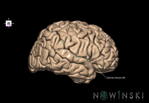 G1.T7.26.V4.C12.L1.Sylvian fissure right