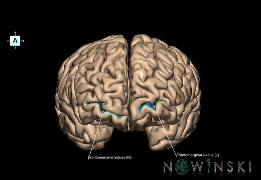 G1.T7.6.V1.C14.L1.Frontomarginal sulcus