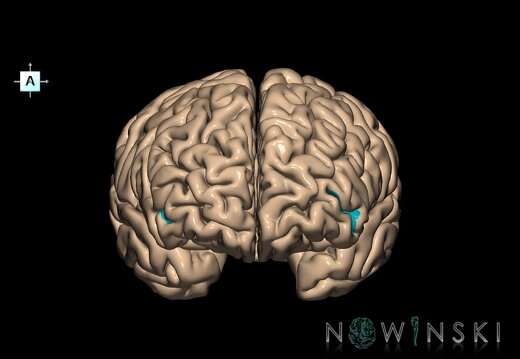 G1.T7.7.V1.C14.L0.Frontoorbital sulcus