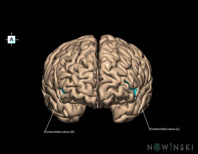 G1.T7.7.V1.C14.L1.Frontoorbital_sulcus.tiff