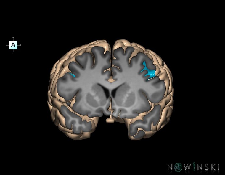 G1.T7.8.V1.C14.S1.L0.Inferior_frontal_sulcus.tiff