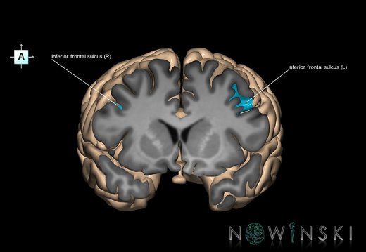 G1.T7.8.V1.C14.S1.L1.Inferior frontal sulcus