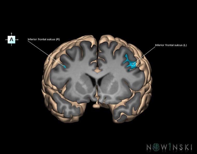 G1.T7.8.V1.C14.S1.L1.Inferior_frontal_sulcus.tiff