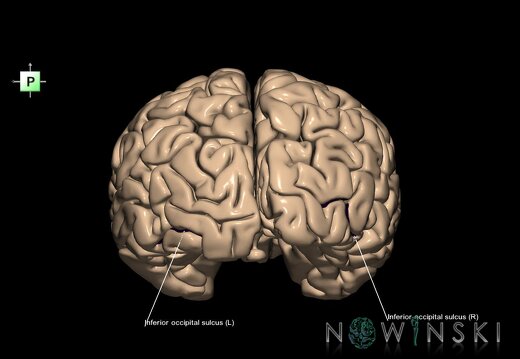 G1.T7.9.V3.C14.L1.Inferior occipital sulcus