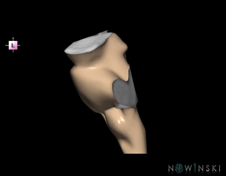 G1.T9.V2.C1.L0.Brainstem.tiff