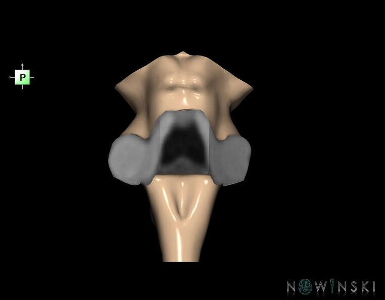 G1.T9.V3.C1.L0.Brainstem.tiff