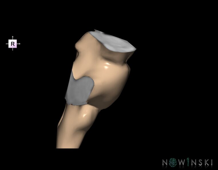 G1.T9.V4.C1.L0.Brainstem.tiff
