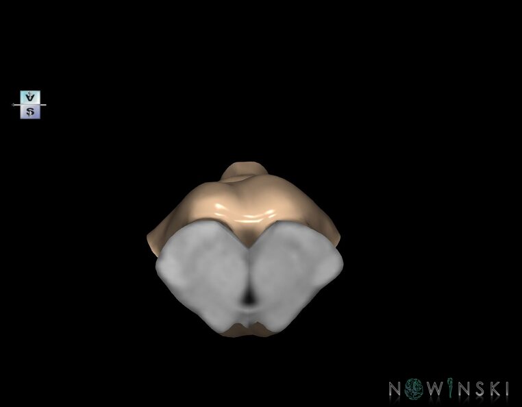 G1.T9.V5.C1.L0.Brainstem.tiff