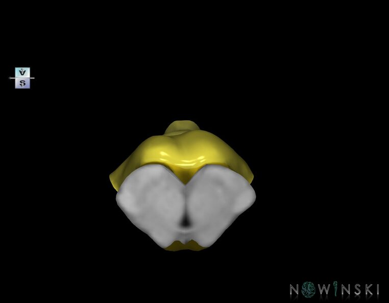G1.T9.V5.C2.L0.Brainstem.tiff