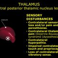 G11.T11.RegionalAnatomyDisorders.DeepNuclei.Thalamus.Ventral posterior thalamic nucleus lesion