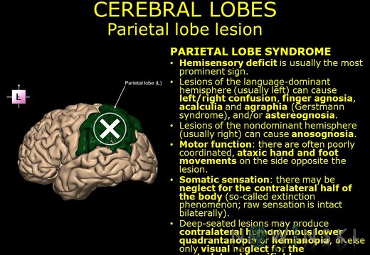 G11.T4.2.RegionalAnatomyDisorders.CerebralLobes.Parietal lobe lesion