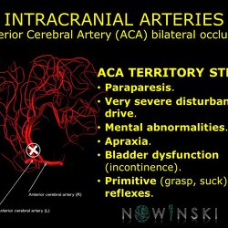 G11.T15.5.VascularDisorders.AnteriorCerebralArtery.Anterior cerebral artery bilateral occlusion