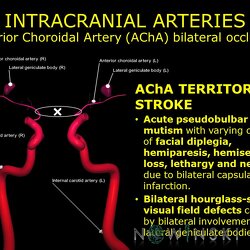 G11.T15.7.VascularDisorders.InternalCarotidArtery.Anterior choroidal artery bilateral occlusion